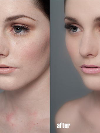 face